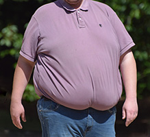 Acute or Chronic Inflammation - The Secret Killer - diseases - obesity
